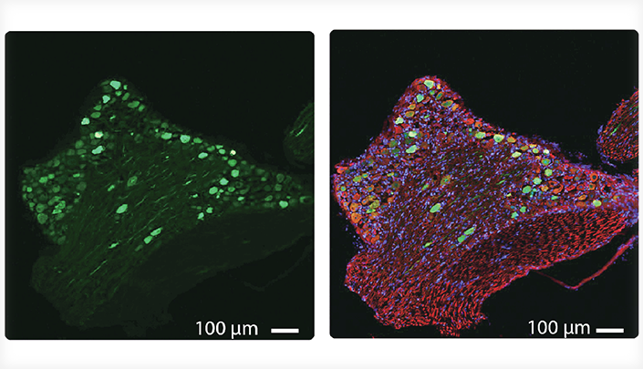 AAV infectivity Data Image courtesy of Dr. Douglas Lopes, King’s College London.