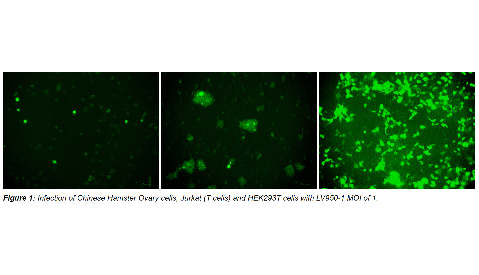 Lentivirus Promoter Blast&trade; kit