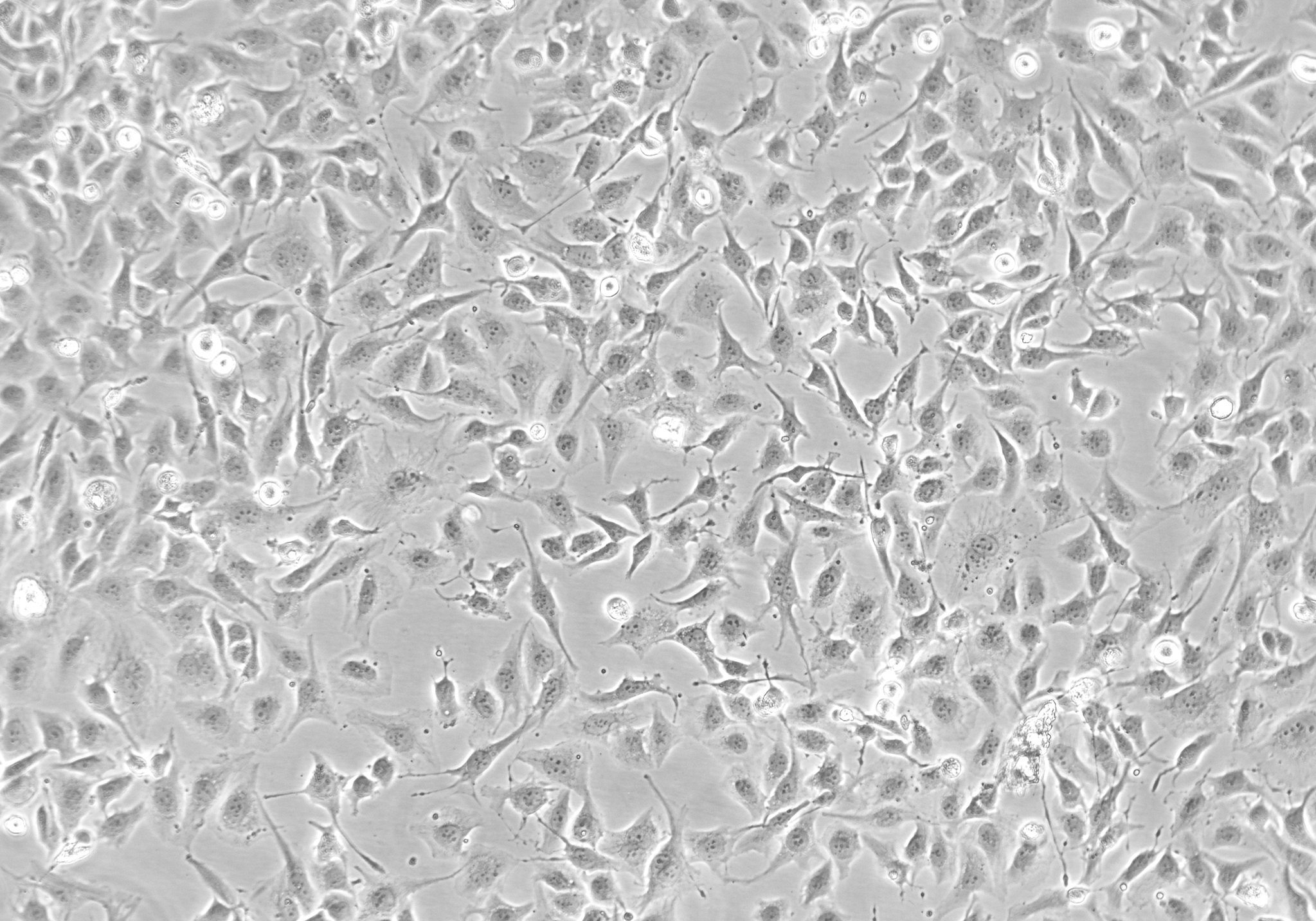 Phase contrast microscopy image of immortalized cells in culture