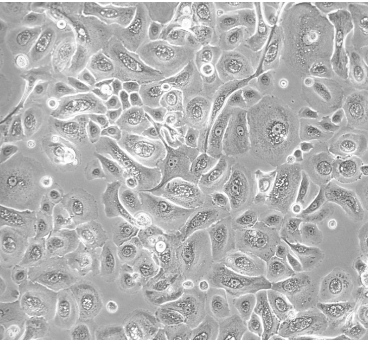 Phase contrast microscopy image of primary cells in culture